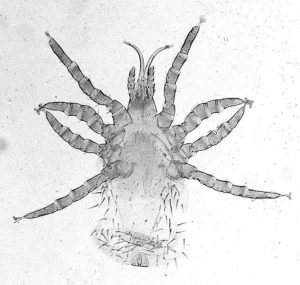 Microscope scan of a bird mite